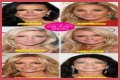 Botox, Implants & More! – Hollywood Life